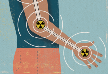 Using Low-Dose Radiation to Treat Osteoarthritis
